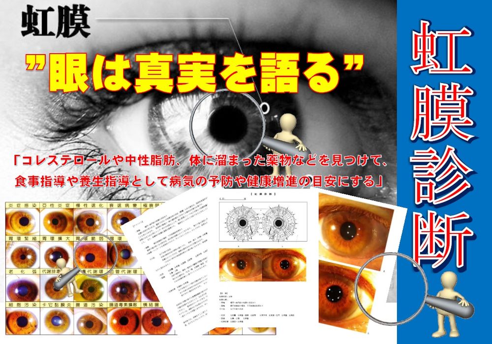 虹膜（虹彩）診断 ー原因の解明と予防に活用ー | 医鍼伝心（症例