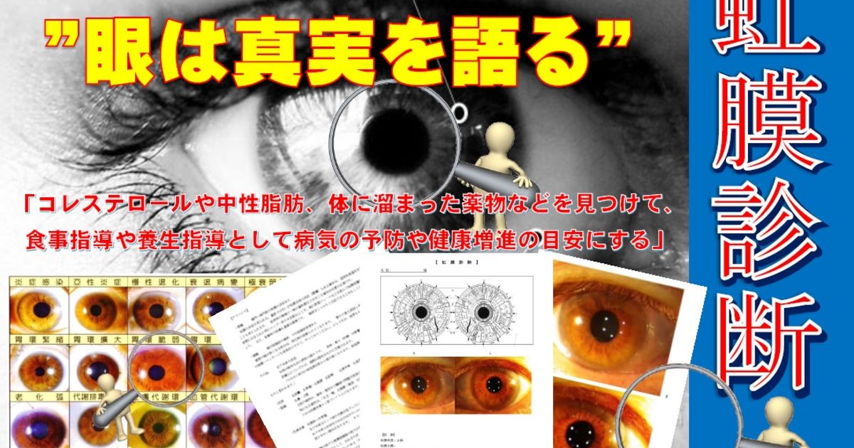 虹膜（虹彩）診断 ー原因の解明と予防に活用ー | 医鍼伝心（症例